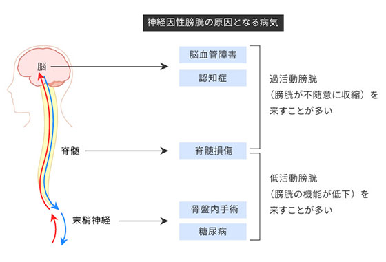 兵庫県神戸市の神経因性膀胱治療｜やまの泌尿器科